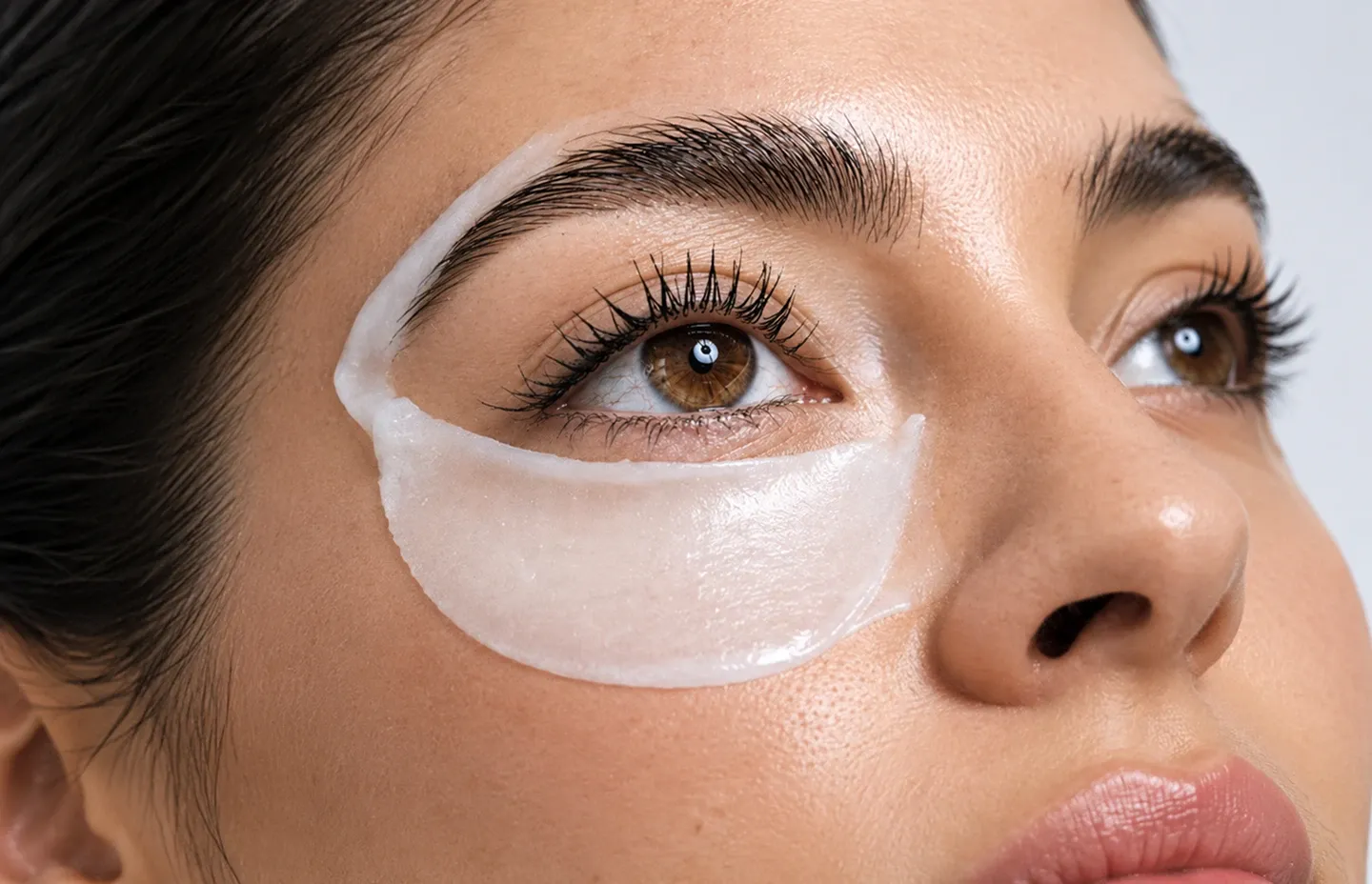 Tratamientos de Ojeras